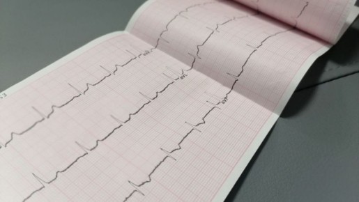 Самарские ученые научились выявлять сердечную недостаточность по голосу