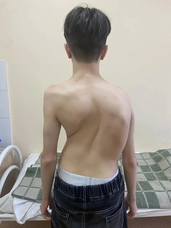 Самарские врачи провели подростку сложную операцию во время ракетной опасности Самарские врачи провели подростку сложную операцию во время ракетной опасности