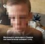 Фотографии мальчика с огромными синяками на лице, которого, по словам соседей, систематически избивает отец, опубликовали в соцсетях