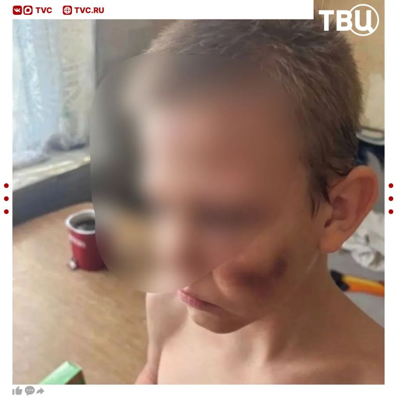 Отец жестоко избивал маленького сына в Самаре Отец жестоко избивал маленького сына в Самаре