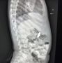Притягивались в животе, разрывая органы: самарские врачи спасли малыша, проглотившего магнитные шарики